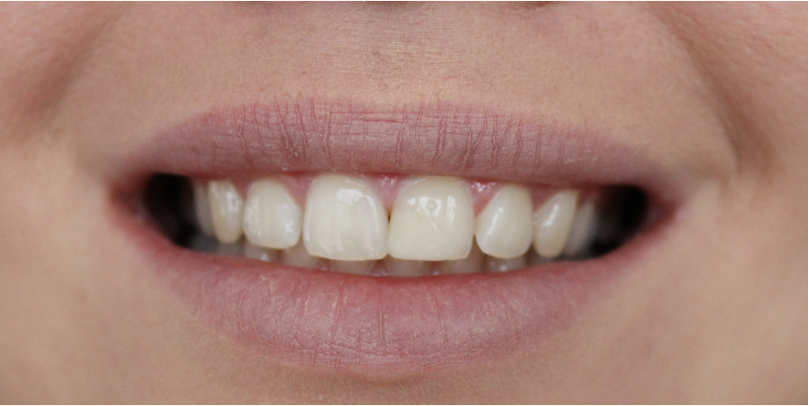 photo white0_zps5e26c03a.png