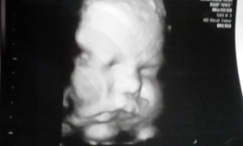 mamas 40wks u0026amp up letu002639s see overdue bumps december 2012 birth overdue babies may face twice the risk of adhd 800x480 mamas 40wks u0026amp up letu002639s see overdue bumps december 2012 birth overdue babies may face twice the risk of adhd 800x480